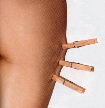 Cellulite: non è una questione di chili