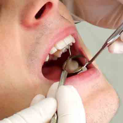 Tipologie di protesi dentali
